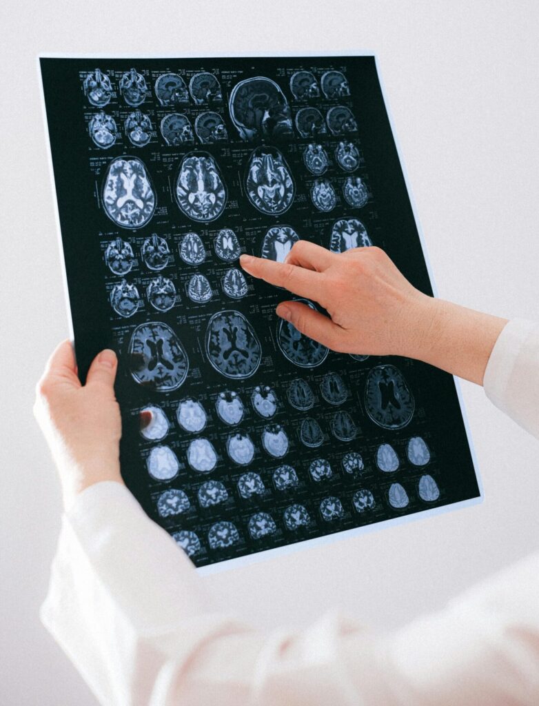 A female doctor holding a brain scan