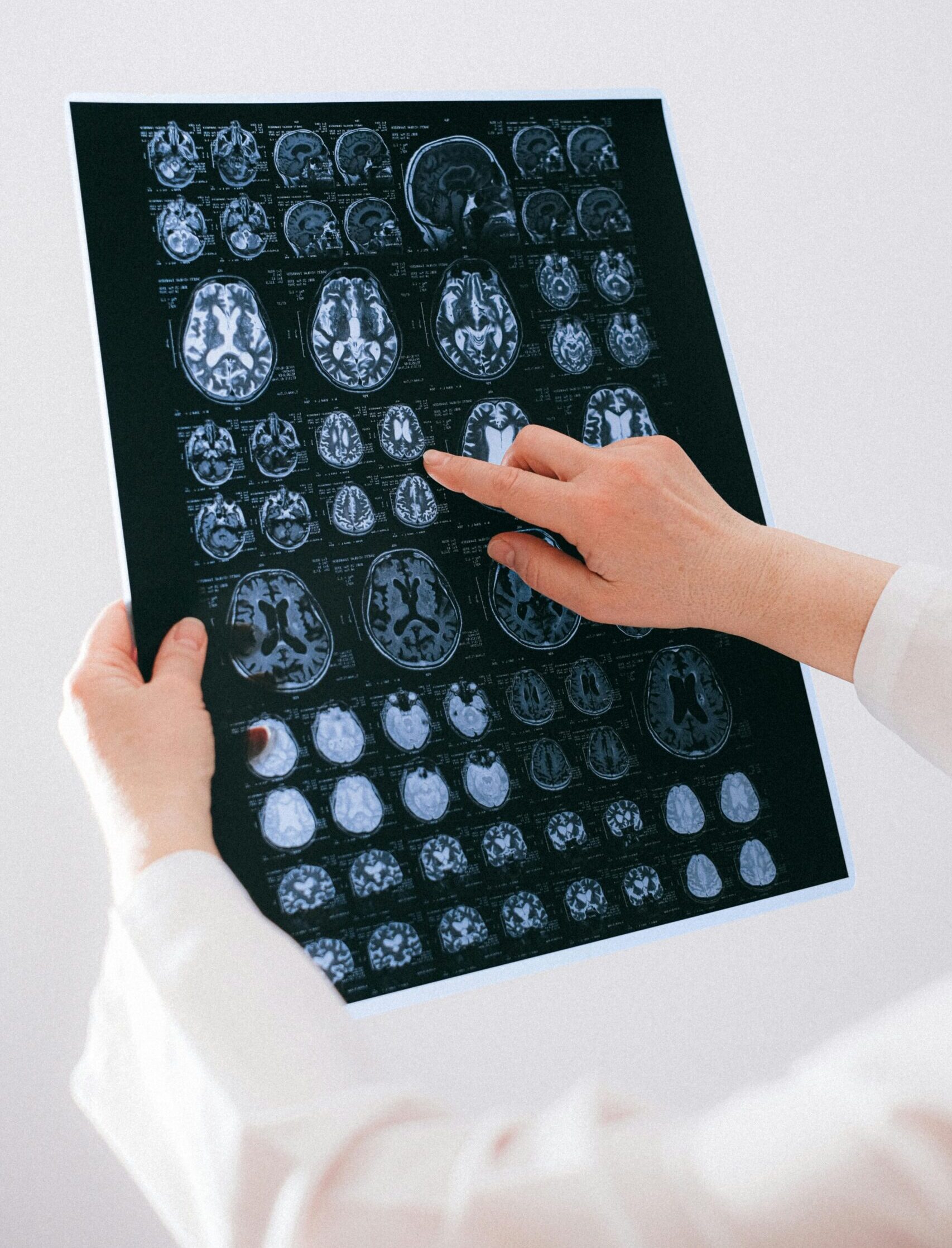 A female doctor holding a brain scan